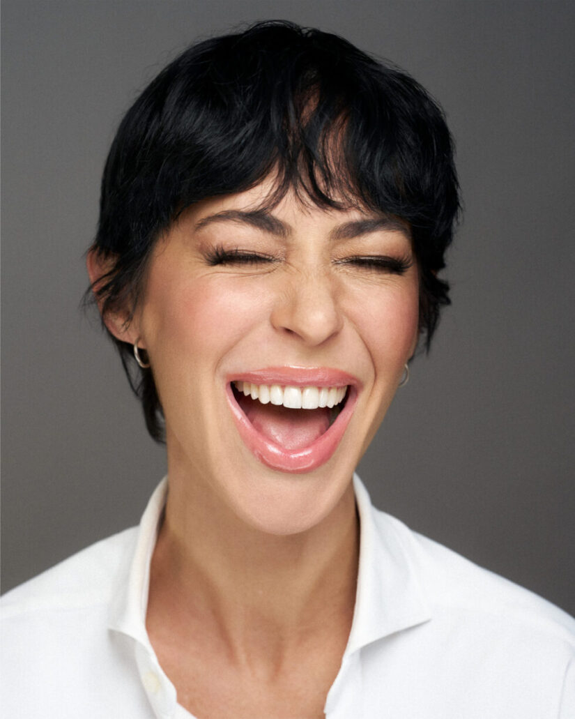 Faccette dentali prima e dopo