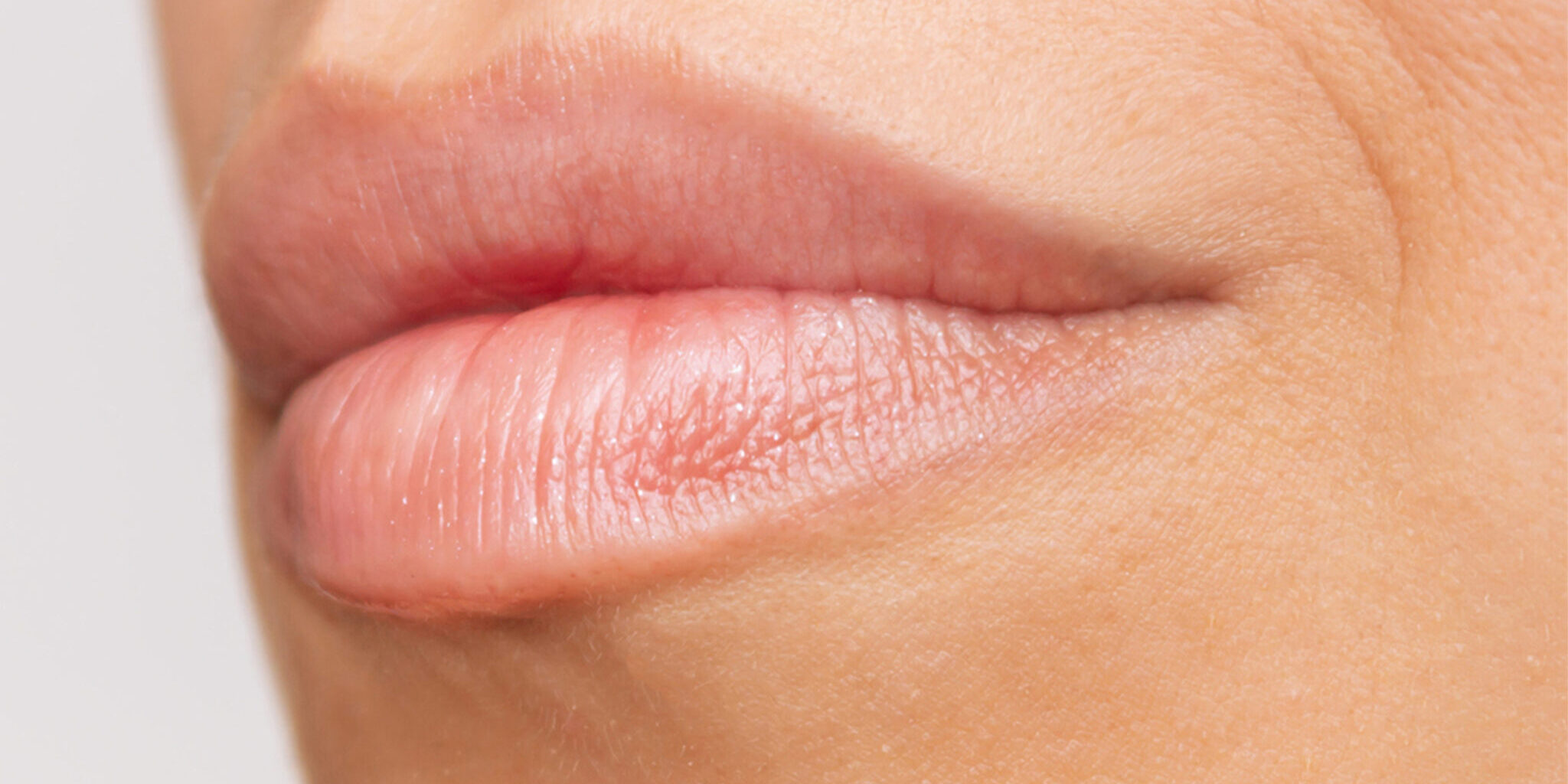 Filler labbra tecnica Russian Lips