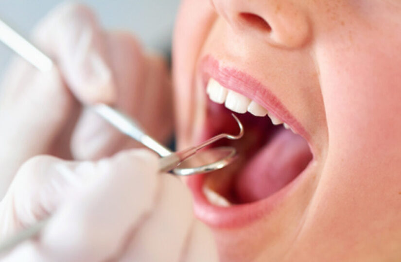 Amalgame dentali a Cattolica