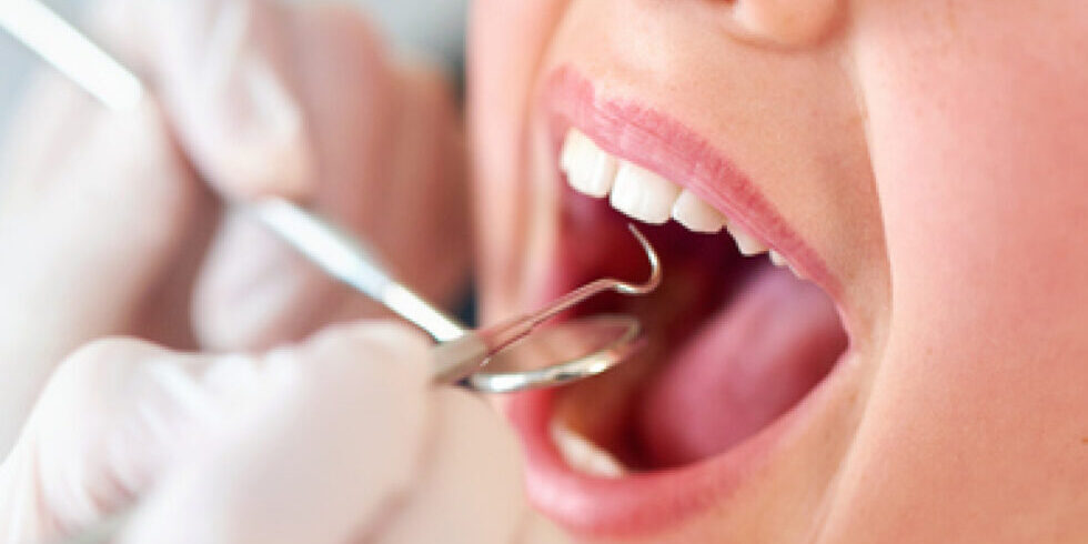 Amalgame dentali: sai che le vecchie otturazioni scure contengono mercurio? Amalgame dentali a Cattolica