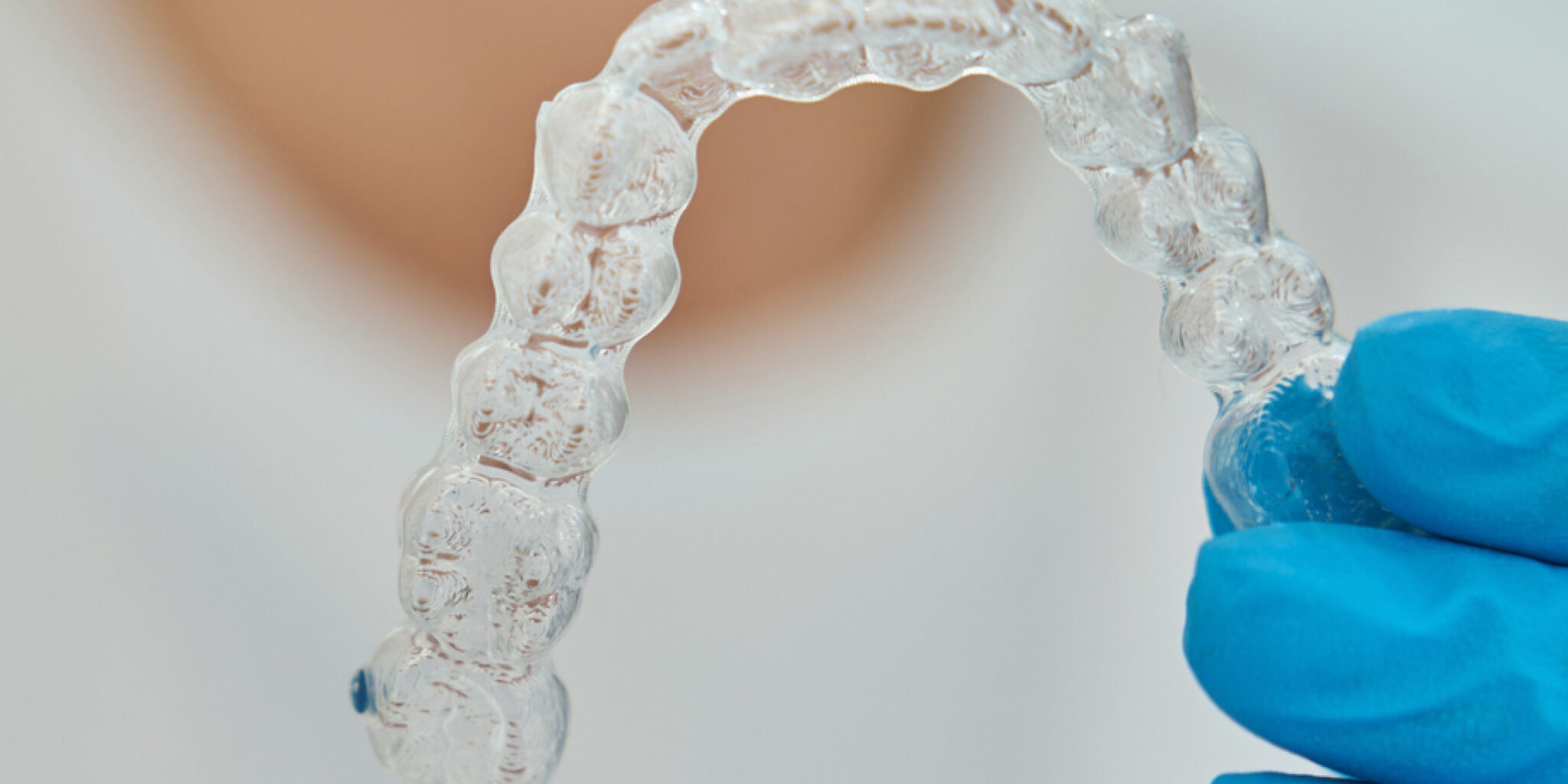 Apparecchio invisalign a Cattolica