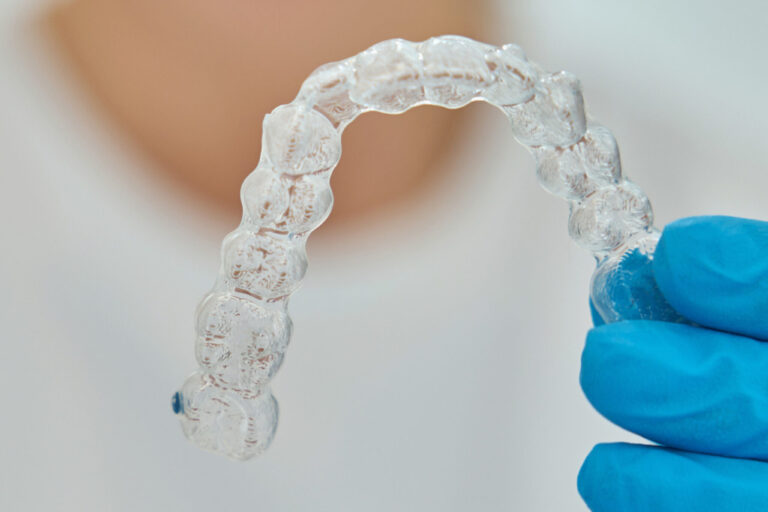 Apparecchio invisalign a Cattolica