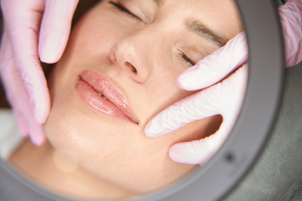 Labbra sottili: filler e metodi per renderle piene e carnose