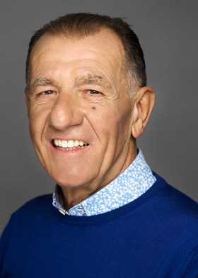 Faccette dentali
