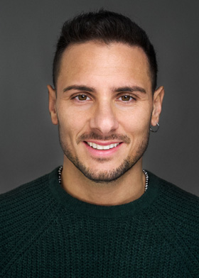 Faccette dentali