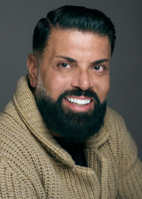 Faccette dentali