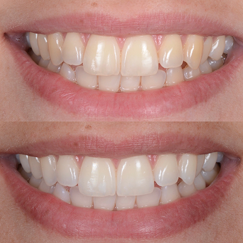 Sorriso perfetto | dentista ferrarini di cattolica
