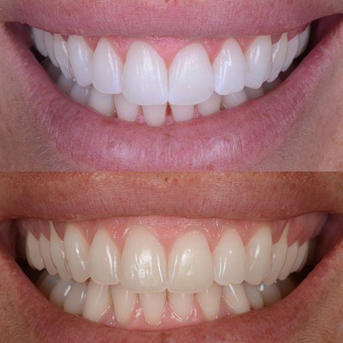 Sorriso perfetto | dentista ferrarini di cattolica